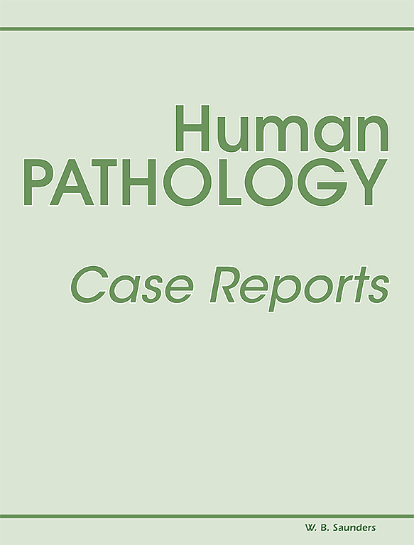 Go to journal home page - Human Pathology: Case Reports